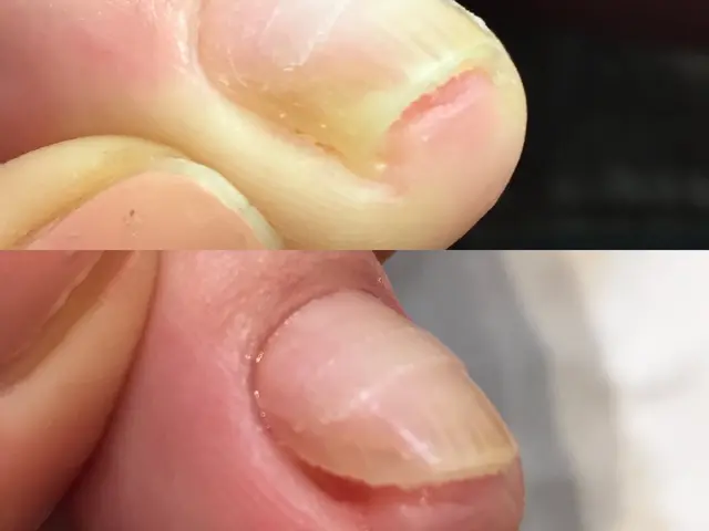 【素っぴん爪エイジングケア】大手ホテル銀座ネイルサロン実務経験あり*