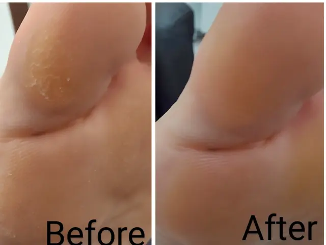 要介護の方や小さなお子様のいらっしゃるお宅にも♪【福祉ネイリスト】【巻き爪ケア】