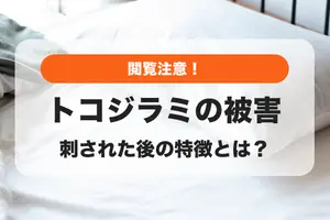 トコジラミ（南京虫）に刺された跡の画像｜完全駆除の方法は？