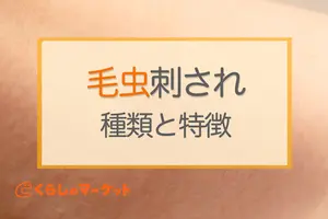 【画像あり】毛虫に刺された跡の特徴│虫の駆除方法も解説