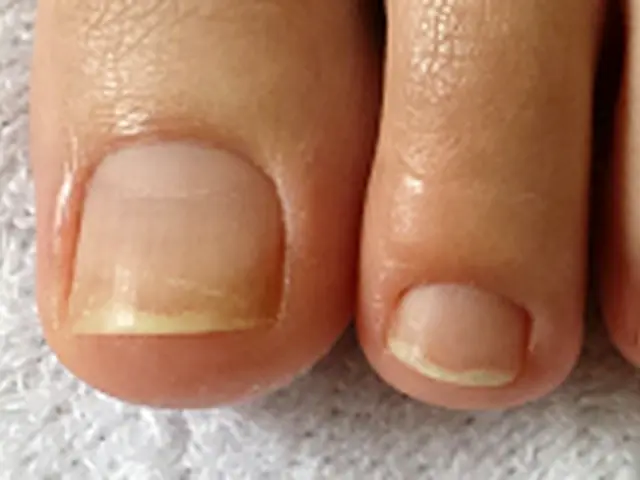 ミドル・シニアに大好評！話しやすさと丁寧な施術で選ばれ続ける訪問ネイルサービス