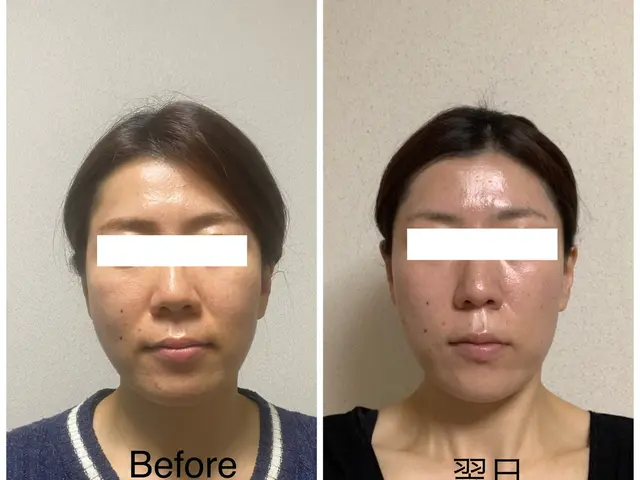 【小顔矯正】完全無痛なのに驚きの効果をぜひ一度体験ください。サービスの画像