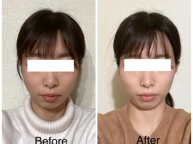 【小顔矯正】完全無痛なのに驚きの効果をぜひ一度体験ください。サービスの画像