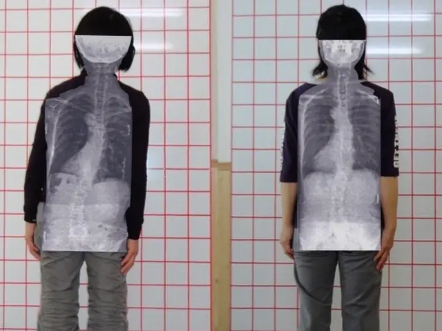 23年実績！10万人以上のお客様を施術！自宅で体のゆがみを矯正します。サービスの画像