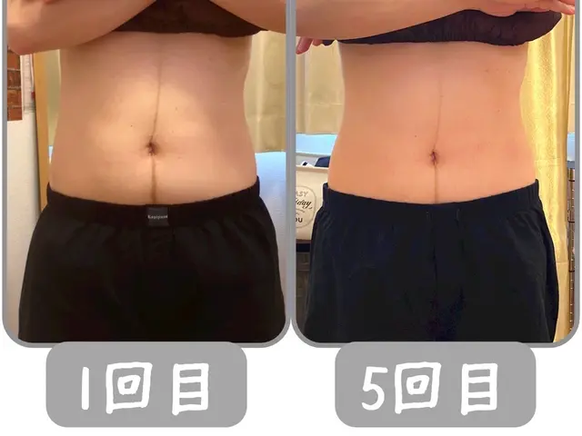 産後1ヶ月から始める骨盤ケアサービスの画像