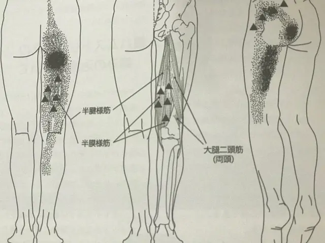 辛いコリや痛みにピンポイント！国家資格者による「トリガーポイント出張整体」サービスの画像