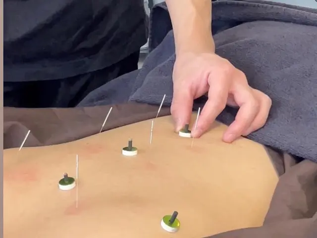 【有国家資格保持者】新感覚*脳疲労リセット*刺さない鍼とマッサージで全身調整ケアサービスの画像