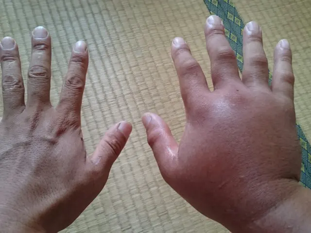 ☆蜂駆除の資格「防除作業監督者所持」忌避剤込みアシナガバチは8800円からサービスの画像