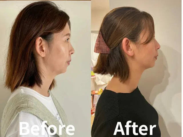 輪郭くっきり！若見えリフトアップ小顔整顔/小顔矯正サービスの画像