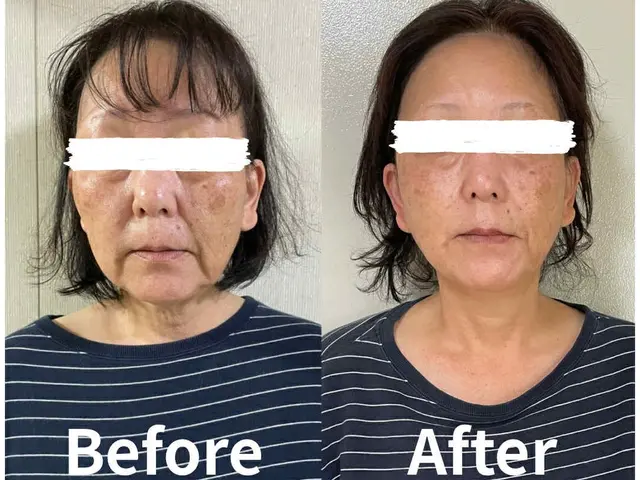 輪郭くっきり！若見えリフトアップ小顔整顔/小顔矯正サービスの画像