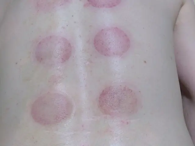 頑固な肩コリ、首コリ、コリからくる頭痛に対応してます。サービスの画像