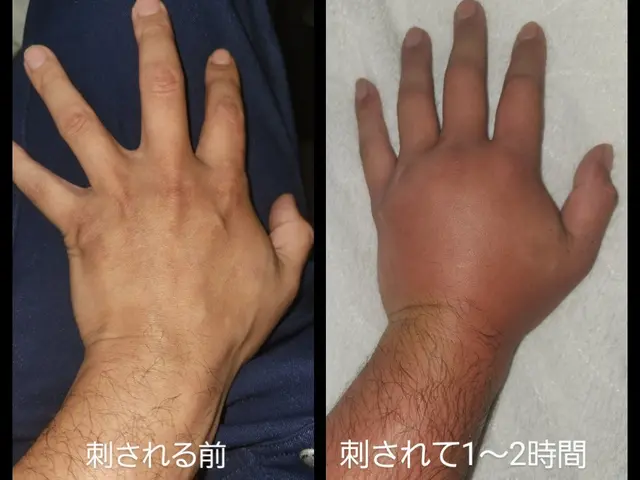 【アシナガバチ9000円～】◎2ヶ月の無料保証■即日、翌日対応可能！サービスの画像