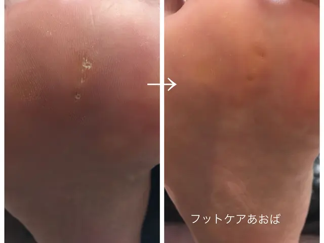 手足の爪切り&お手入れ