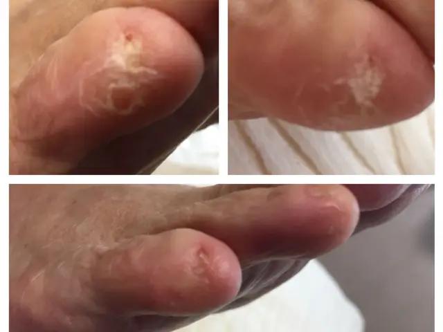 手足の爪切り&お手入れ