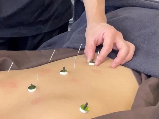 12月末まで！初回30%OFF特別プラン！*脳疲労リセット*秋冬のケア整体・鍼灸サービスの画像