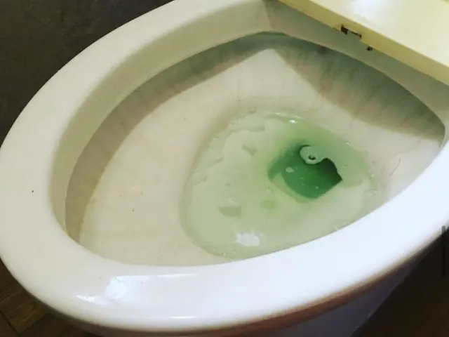 ♪トイレピカピカクリーニング♪豊富な経験と知識で安心！しっかり落とします！サービスの画像