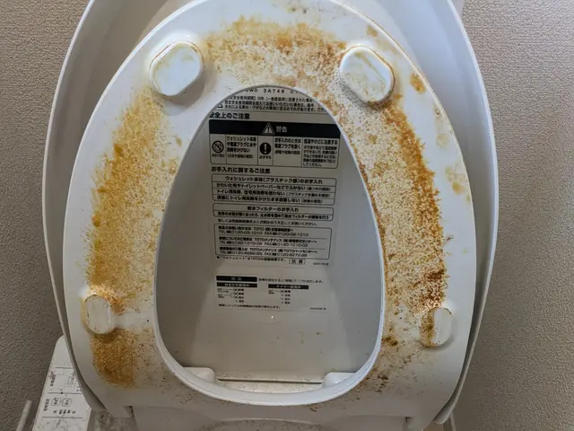 ★ウォシュレットの黄ばみ★トイレクリーニング9000円★サービスの画像